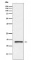 Anti-Prealbumin TTR Rabbit Monoclonal Antibody
